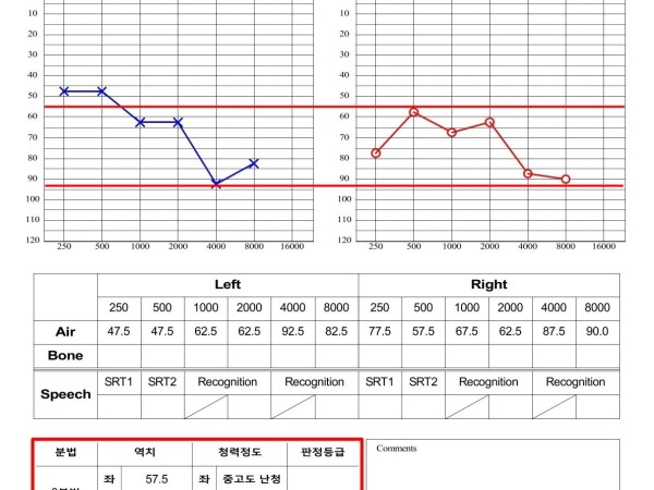 고령 환자의 이명과 우측 중고도 난청, 집중 치료 후 청력 향상 사례