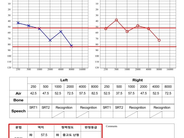 양측 심한 난청과 이명, 집중 치료 2주 만에 정상 청력 회복