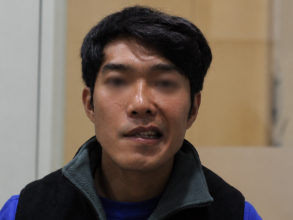 청주에서 장거리 내원, 집중 치료를 통해 안면 근육 유연성 및 마비 호전
