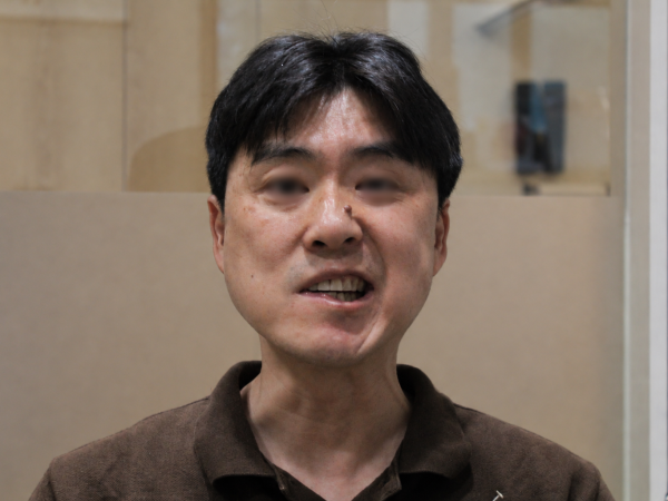 신경 손상 5단계 중증 환자, 맞춤 침구 및 한약 치료로 얼굴 균형 회복