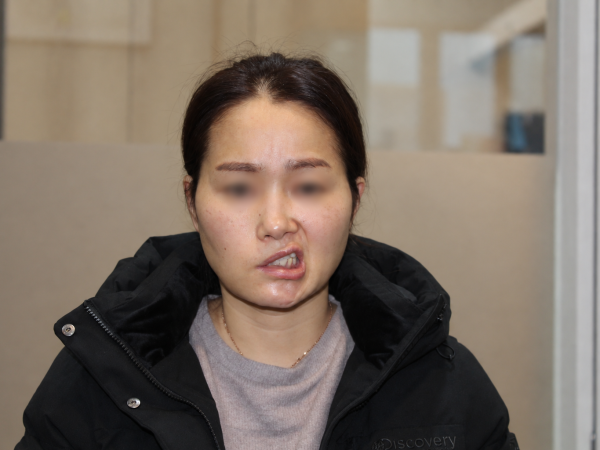 타한의원 3개월 치료 불효 후 내원, 정밀 맞춤 치료로 마비 증상 완화