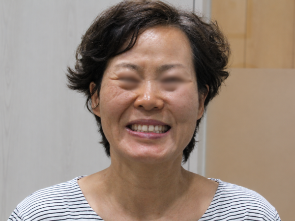 대학병원 치료 후 차도 없던 안면마비, 3개월 치료로 개선
