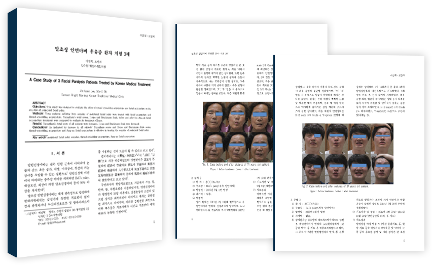 안면질환 한방 치료