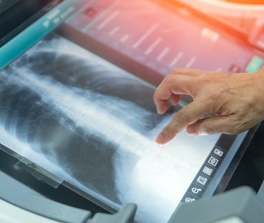 X-ray 검사