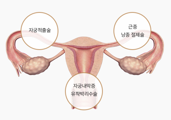 부인과 수술 후 입원·외래 관리 안내
