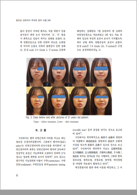 논문 자료 4