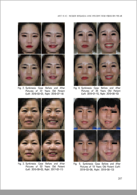 논문 자료 4